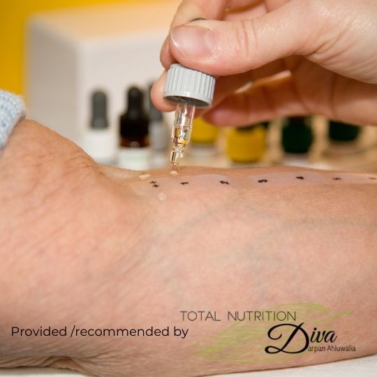 RMA FST™ IgG Allergy Testing*