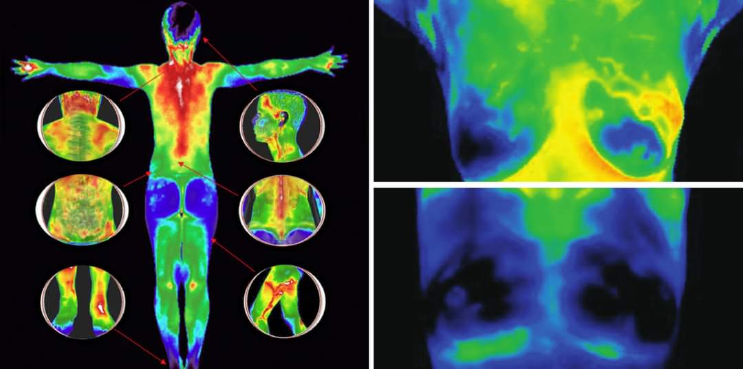 Thermography Full Body Scan